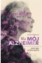 Nie mój alzheimer