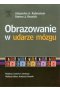 Obrazowanie w udarze mózgu