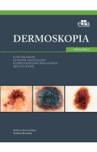 Dermoskopia