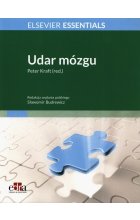 Udar mózgu