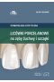 Licówki porcelanowe na zęby żuchwy i szczęki