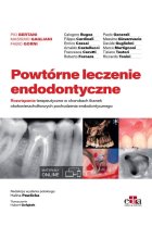 Powtórne leczenie endodontyczne