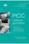 PICC i wkłucia pośrednie