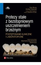 Protezy stałe