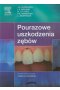 Pourazowe uszkodzenia zębów