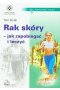 Rak skóry - jak zapobiegać i leczyć