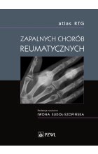 Atlas RTG zapalnych chorób reumatycznych