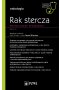 Rak stercza. Współczesne spojrzenie