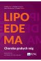 Lipoedema