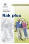 Rak płuc