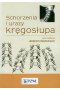 Schorzenia i urazy kręgosłupa