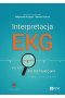 Interpretacja EKG.