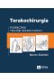 Torakochirurgia